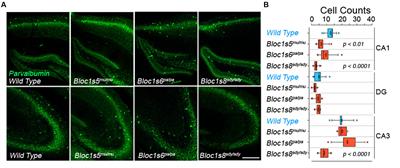 Dysbindin Deficiency Modifies the Expression of GABA Neuron and Ion Permeation Transcripts in the Developing Hippocampus